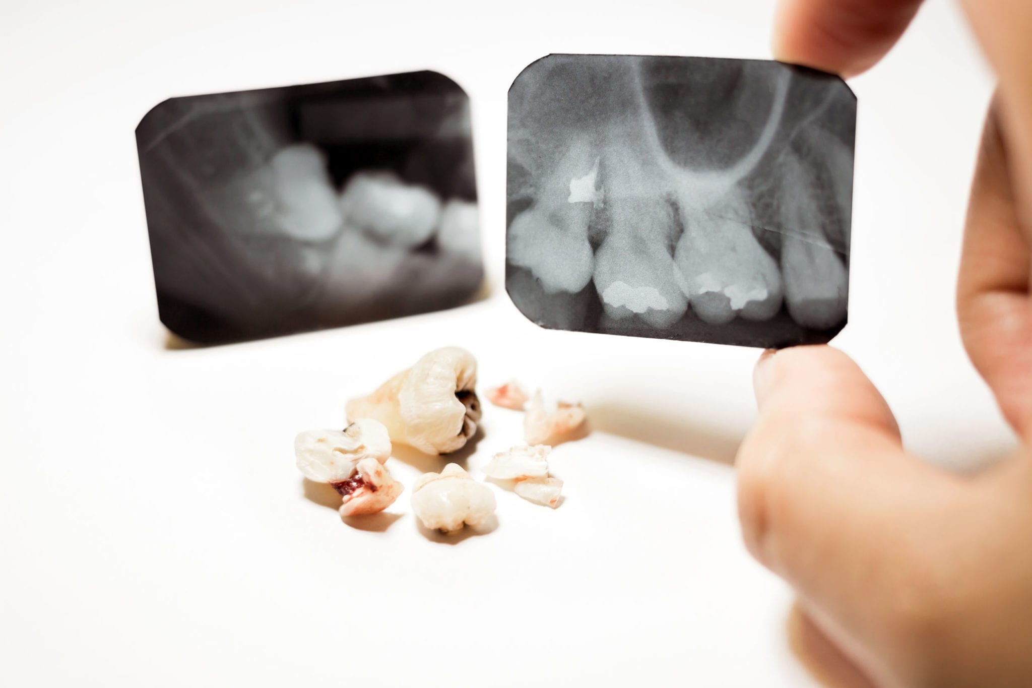 Elements of a Florida Dentist Malpractice Case