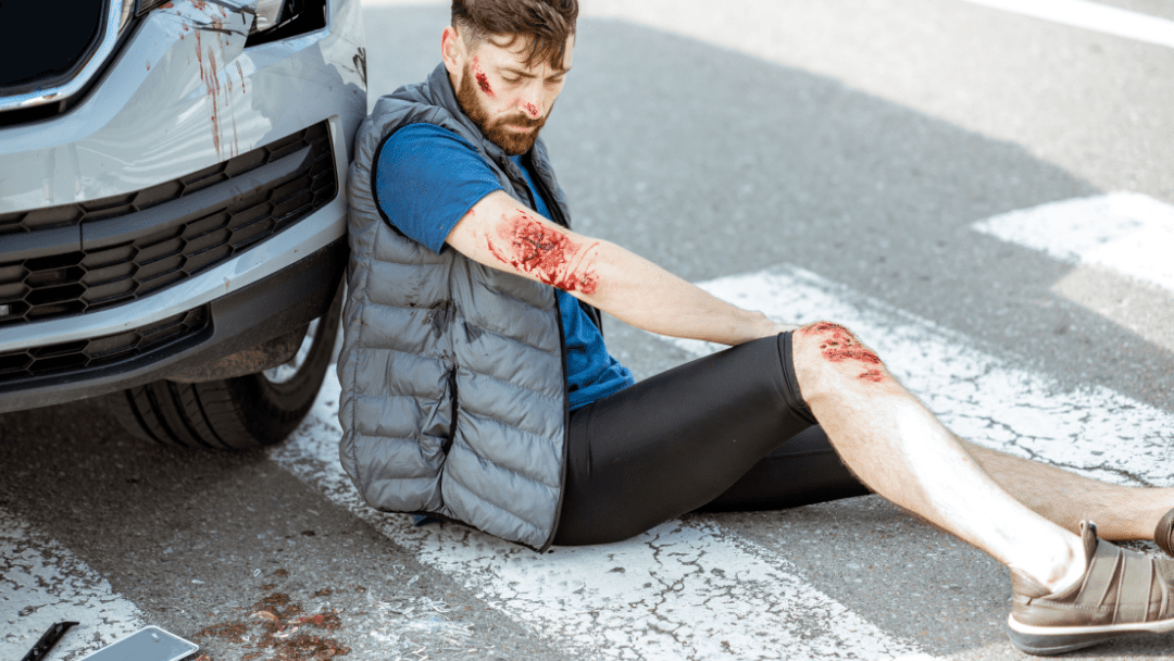 What If You’re Hurt in a Pedestrian Car Accident in Florida?